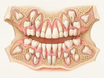 A cross-section of a child's upper and lower jaws shows mixed dentition, with permanent front teeth and first molars emerging while baby teeth remain, and developing canines, premolars, and wisdom teeth visible inside the gums and bone.